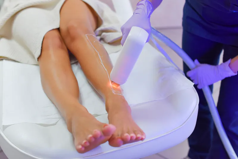 Laser Hair on Legs for Silky, Radiant Results at MC Aesthetics McMinnville